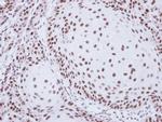 SART1 Antibody in Immunohistochemistry (Paraffin) (IHC (P))