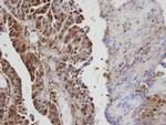 VAV1 Antibody in Immunohistochemistry (Paraffin) (IHC (P))