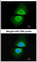 CYP4A11 Antibody in Immunocytochemistry (ICC/IF)