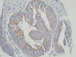 CYP4A11 Antibody in Immunohistochemistry (Paraffin) (IHC (P))