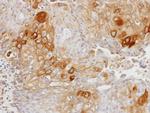 GK2 Antibody in Immunohistochemistry (Paraffin) (IHC (P))