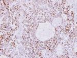 Creatine Kinase MT Antibody in Immunohistochemistry (Paraffin) (IHC (P))