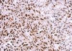 SAMHD1 Antibody in Immunohistochemistry (Paraffin) (IHC (P))