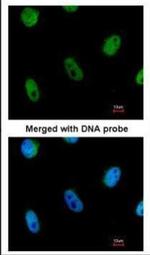 L3MBTL1 Antibody in Immunocytochemistry (ICC/IF)