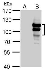 L3MBTL1 Antibody in Western Blot (WB)