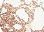 Angiotensinogen Antibody in Immunohistochemistry (Paraffin) (IHC (P))