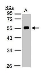 Angiotensinogen Antibody in Western Blot (WB)