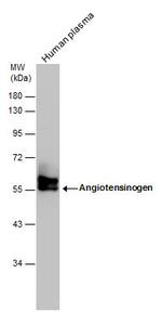 Angiotensinogen Antibody in Western Blot (WB)