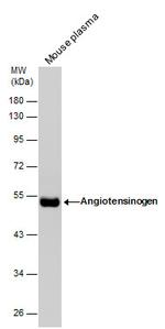 Angiotensinogen Antibody in Western Blot (WB)