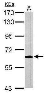 MPP2 Antibody in Western Blot (WB)