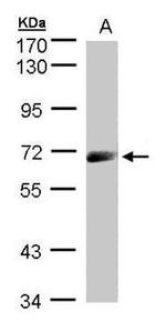 IL12RB1 Antibody in Western Blot (WB)