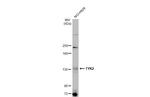 TYK2 Antibody in Western Blot (WB)