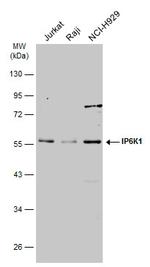 IP6K1 Antibody in Western Blot (WB)