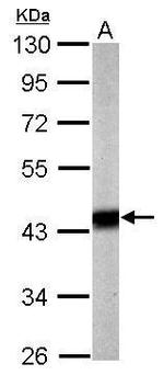 PDHA1 Antibody in Western Blot (WB)