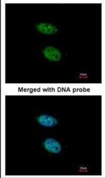 PRPS2 Antibody in Immunocytochemistry (ICC/IF)