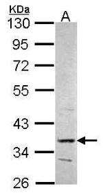 PRPS2 Antibody in Western Blot (WB)