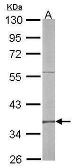 RFC4 Antibody in Western Blot (WB)