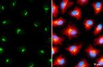 GALNT2 Antibody in Immunocytochemistry (ICC/IF)