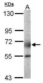 GALNT2 Antibody in Western Blot (WB)