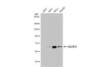 GALNT2 Antibody in Western Blot (WB)