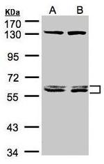 DNAJC7 Antibody in Western Blot (WB)