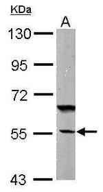 DNAJC7 Antibody in Western Blot (WB)