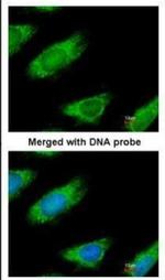 ME1 Antibody in Immunocytochemistry (ICC/IF)