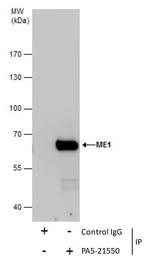 ME1 Antibody in Immunoprecipitation (IP)