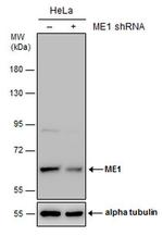 ME1 Antibody