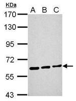 ME1 Antibody in Western Blot (WB)