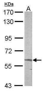 ALAS2 Antibody in Western Blot (WB)