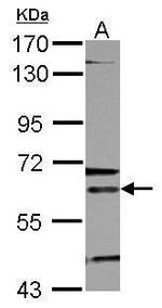 ALAS2 Antibody in Western Blot (WB)