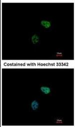 PSMC6 Antibody in Immunocytochemistry (ICC/IF)