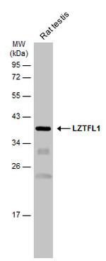 LZTFL1 Antibody in Western Blot (WB)