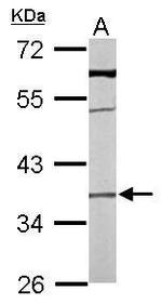 TMEM59 Antibody in Western Blot (WB)