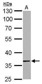 TMEM59 Antibody in Western Blot (WB)