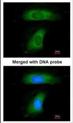 BLNK Antibody in Immunocytochemistry (ICC/IF)