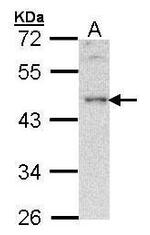 BLNK Antibody in Western Blot (WB)