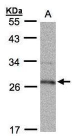 15-PGDH Antibody in Western Blot (WB)