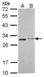 SDHB Antibody in Western Blot (WB)