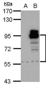 PDE4D Antibody in Western Blot (WB)