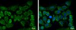 CLPP Antibody in Immunocytochemistry (ICC/IF)