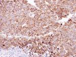 CLPP Antibody in Immunohistochemistry (Paraffin) (IHC (P))