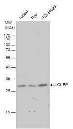 CLPP Antibody in Western Blot (WB)