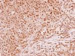 MAD2 Antibody in Immunohistochemistry (Paraffin) (IHC (P))