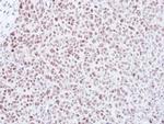 MAD2 Antibody in Immunohistochemistry (Paraffin) (IHC (P))