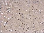 MAD2 Antibody in Immunohistochemistry (Paraffin) (IHC (P))