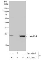 MAD2 Antibody in Immunoprecipitation (IP)