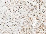 UBE2L3 Antibody in Immunohistochemistry (Paraffin) (IHC (P))