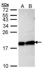 UBE2L3 Antibody in Western Blot (WB)